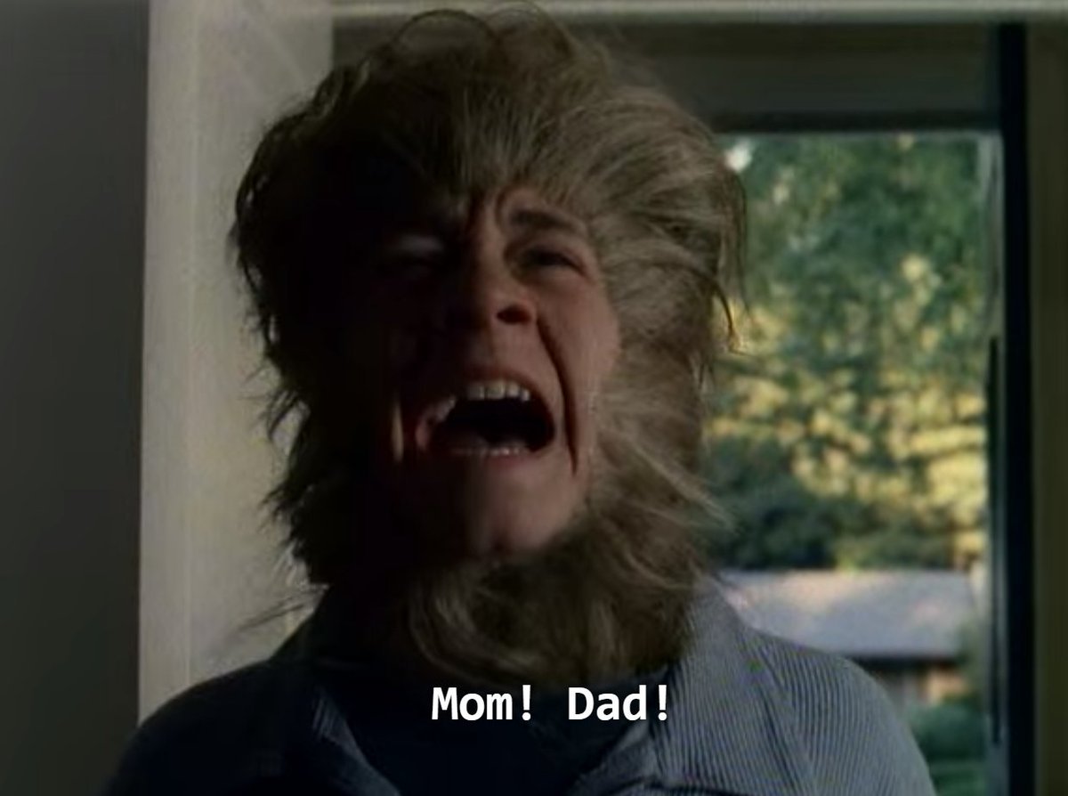 Goosebumps Season 1: Episode 11: My Hairiest Adventure